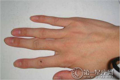 手心有痣,手指有痣运势 手心有痣,手指有痣运势